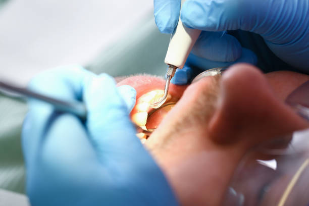 Best After-Hours Emergency Dentist in Tyndall, SD